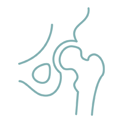 +25 Punkte: Spürbarer Fortschritt der Hüftfunktion